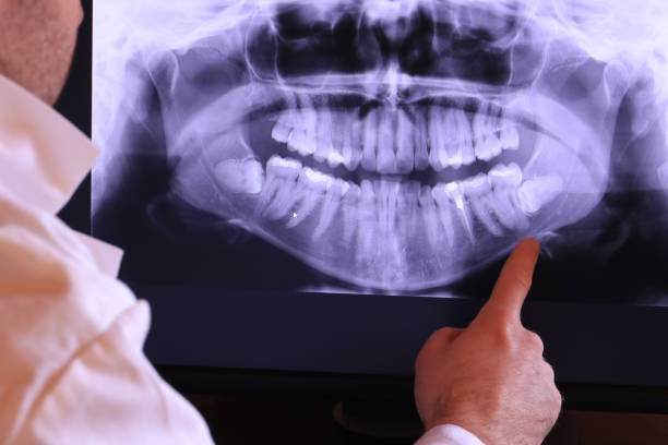 Best Emergency Treatment for Toothache in Wolf Lake, MI